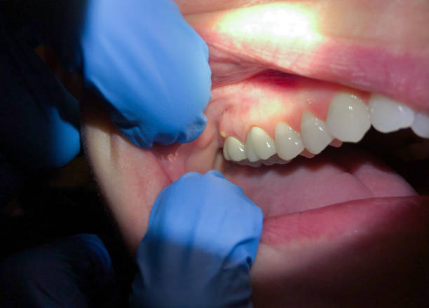 Best Urgent Tooth Repair  in Bardonia, NY